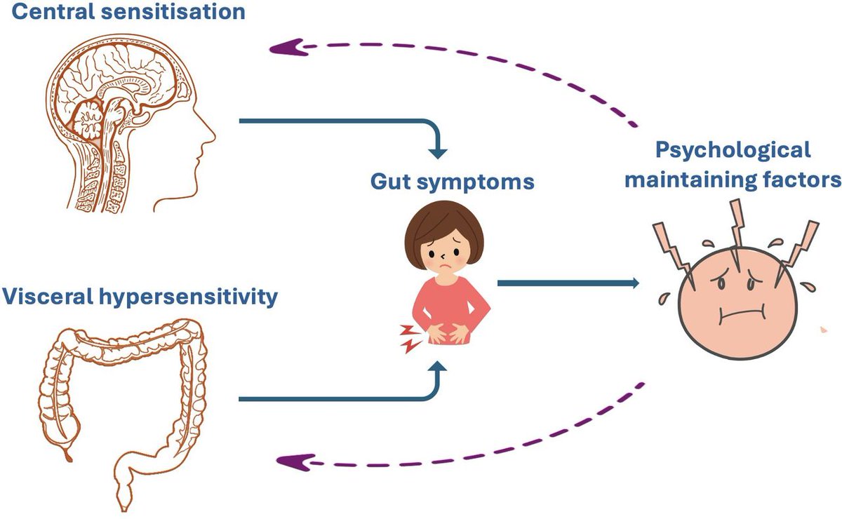 FrontGastro_BMJ's tweet image. 🧠💥 Gut–brain disorders are real — and central neuromodulators are key to recovery!

But many gastroenterologists lack confidence in prescribing them 😬💊

This new @FrontGastro_BMJ review by @fikster123 and colleagues 📰 is your practical guide to:
🔹 Tricyclics
🔹 SSRIs/SNRIs…