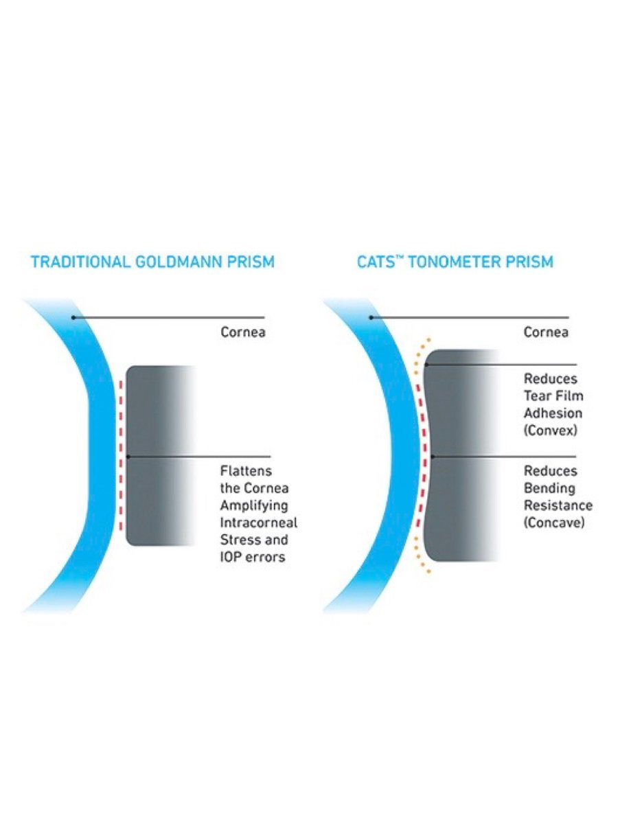 Intuortec's tweet image. CATS® Tonometer Prism features a unique, patented, dual-curved surface design that successfully reduces measurement errors caused by corneal biomechanics, corneal thickness, and tear film, which affect a large percentage of patients.

#glaucoma