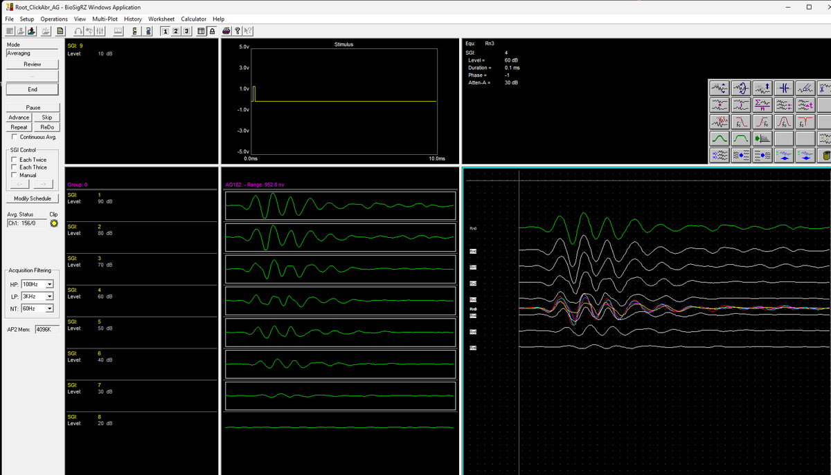 AGungorAydin's tweet photo. First ephys recordings in my own lab!!!🥹Can’t believe it’s happening. The first of many to come! Let’s gooo!
#NewPI #neuroscience #ephys https://t.co/LY44njzZFM