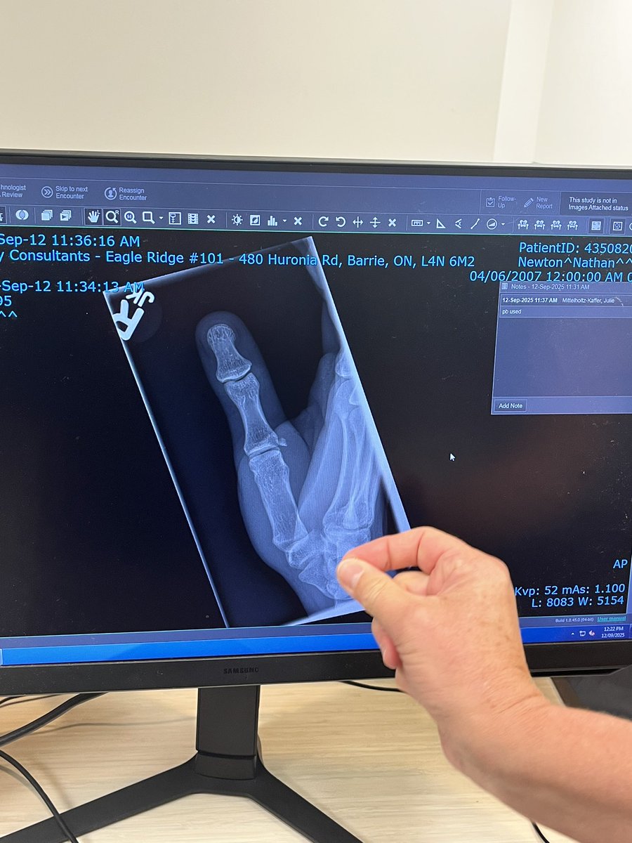 Kositv_'s tweet photo. No video games for a little broke my thumb https://t.co/Svk6nUZpdC