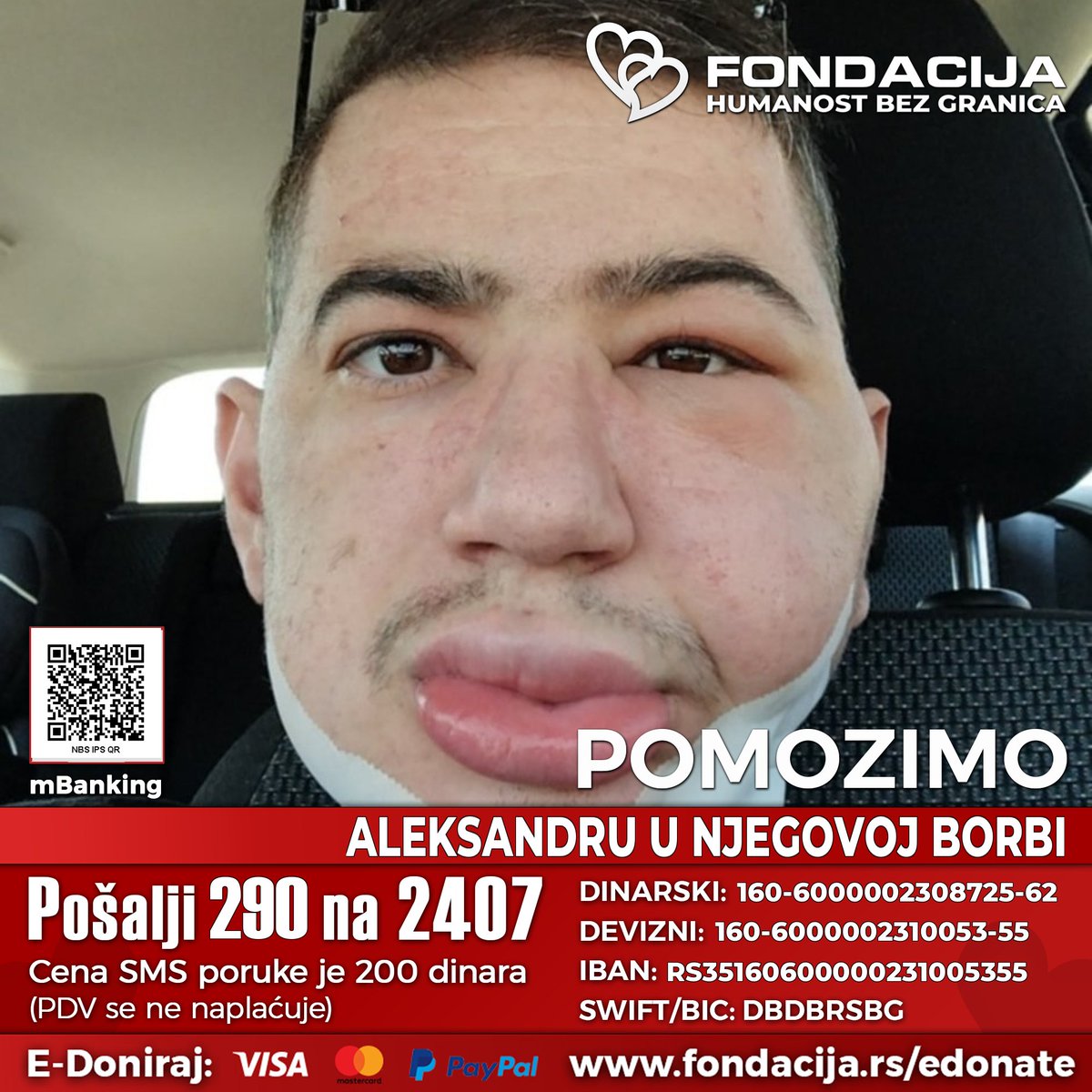 1na2407's tweet image. ZAPRATI NAŠ PROFIL, PODELI TVIT I POMOZI DECI!🙏
🇷🇸 Pošalji SMS: 290 na 2407

Aleksandar (1993.) vodi najtežu bitku – protiv raka gornje površine jezika (C02.0). Za nastavak lečenja u Turskoj hitno su mu potrebna sredstva. Pomozimo mu da dobije ovu bitku i pružimo mu šansu za…