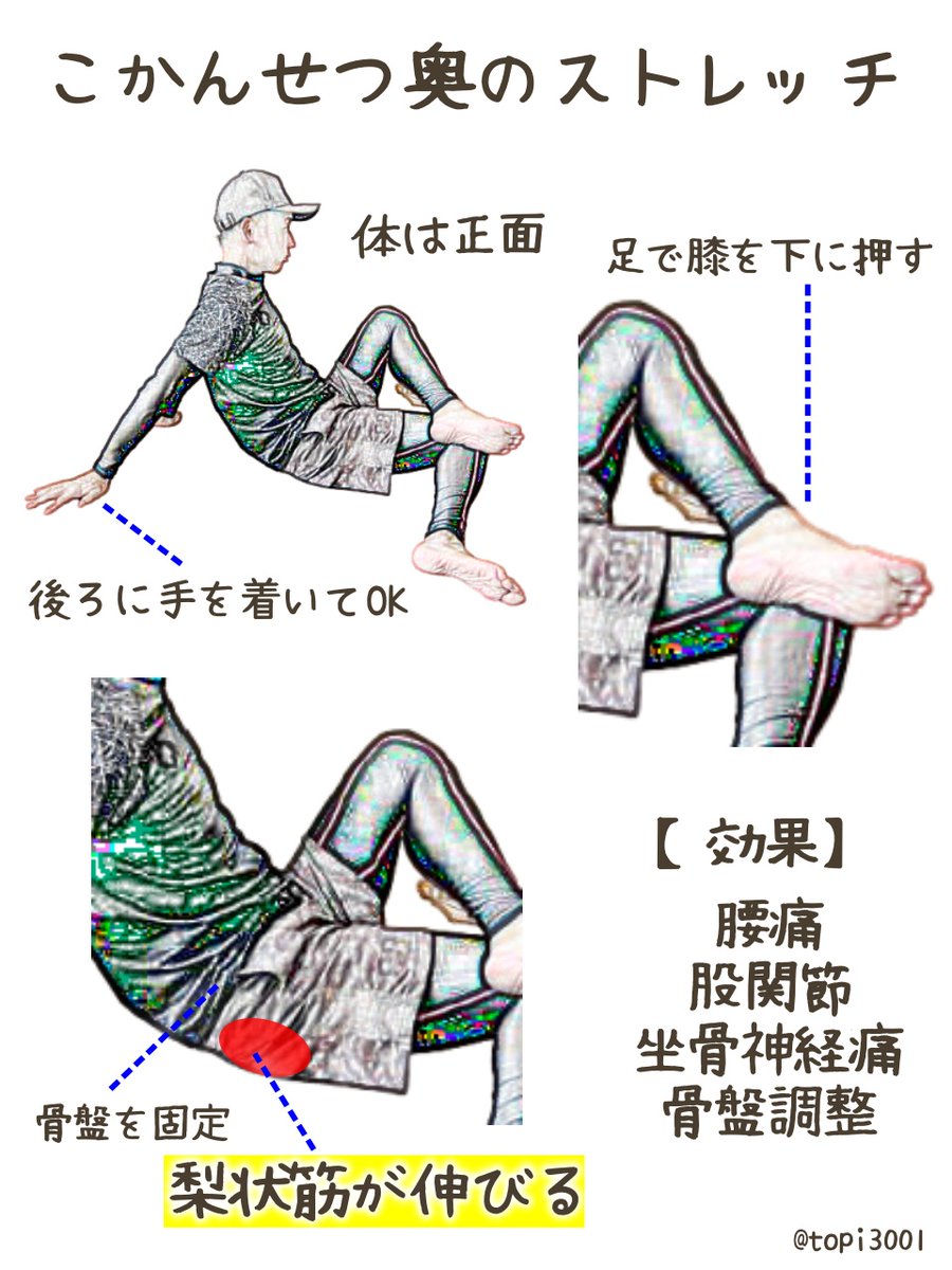 topi3001's tweet photo. 「腰が痛い！」と言ってきた中学生Sくん。チェックしてみると…原因は腰ではなくお尻の筋肉でした。実は「腰が痛い」と訴える人の中には、お尻の奥（りじょう筋）の硬さが原因になっているケースがとても多い。イス生活が増えた現代は、股関節がカタくなりやすい。だからこそ、日頃からお尻を伸ばすストレッチが大切。