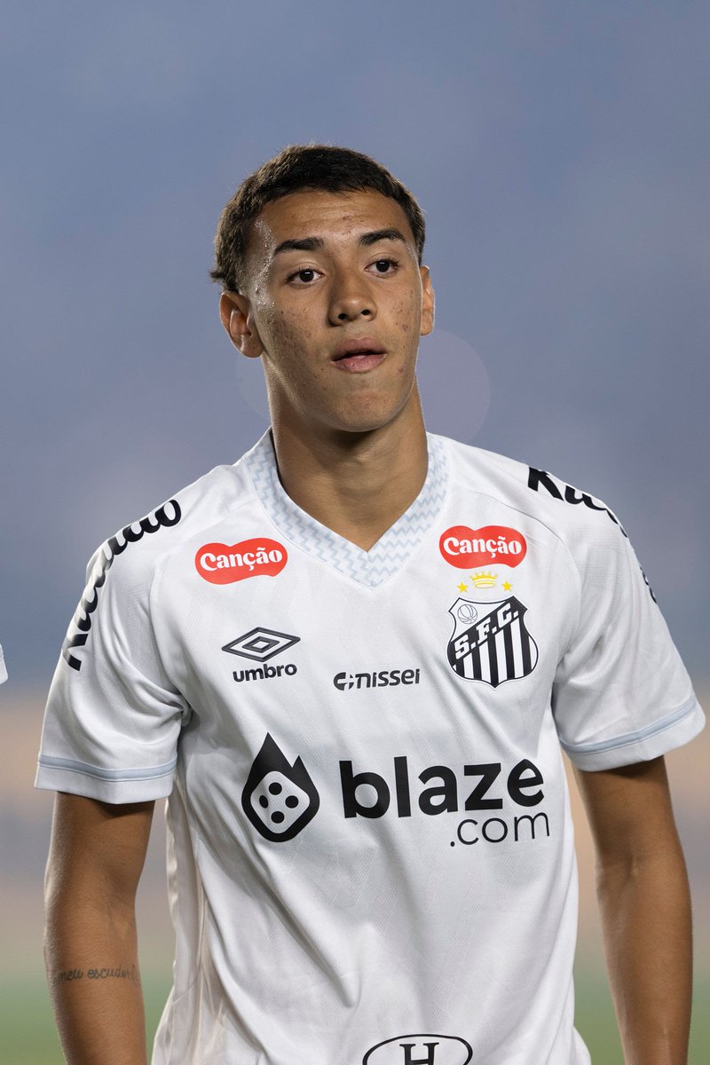 Coordenador do núcleo de saúde do <a href="/SantosFC/">Santos FC</a>, Rodrigo Zogaib explica lesão que tirou Gabriel Bontempo dos gramados:

“O Bontempo sofreu uma lesão no músculo adutor, grau 2A na classificação britânica, o que indica uma lesão sem ruptura significativa de fibras, mas com edema um