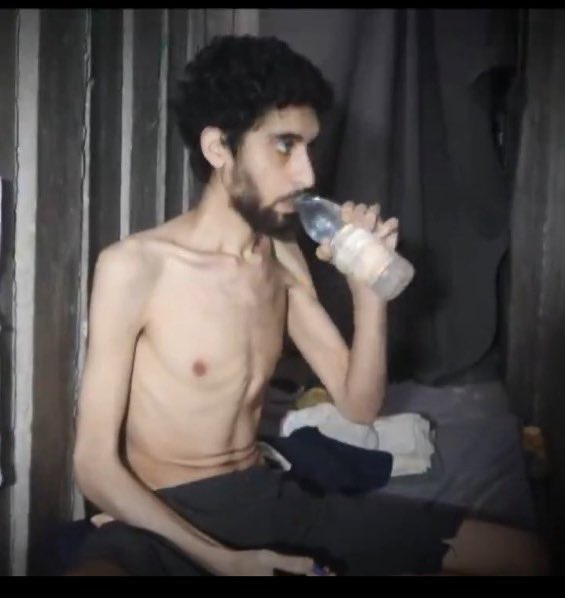 Jérémo 🎗️ (@jeremo12) on Twitter photo Nous sommes le 12 septembre 2025.
Je partagerai la photo de l’otage Evyatar David jusqu’à ce que <a href="/MdM_France/">Médecins du Monde</a>, <a href="/CroixRouge/">Croix-Rouge fr</a> et <a href="/ONU_fr/">Nations Unies (ONU)</a> la publient pour dénoncer la monstruosité du Hamas.
Les amis, faites de même ou relayez ce post.
Merci. On ne les lâchera pas. 🙏🎗️🇮🇱 Nous sommes le 12 septembre 2025.
Je partagerai la photo de l’otage Evyatar David jusqu’à ce que <a href="/MdM_France/">Médecins du Monde</a>, <a href="/CroixRouge/">Croix-Rouge fr</a> et <a href="/ONU_fr/">Nations Unies (ONU)</a> la publient pour dénoncer la monstruosité du Hamas.
Les amis, faites de même ou relayez ce post.
Merci. On ne les lâchera pas. 🙏🎗️🇮🇱
