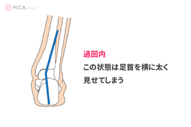 MakeCoreAmazing's tweet photo. 扁平足は足首が太い原因❓🤔

はい、扁平足は足首が太い
原因になります⚠️

ですので姿勢や足裏アーチ等の
対策をしてエクササイズをすれば
足首は細くなります✨

そのための方法を５つ紹介して
いますので今すぐ記事をチェック❗️

👇
https://t.co/Om8IBrXKLt https://t.co/7rZgWsLW08