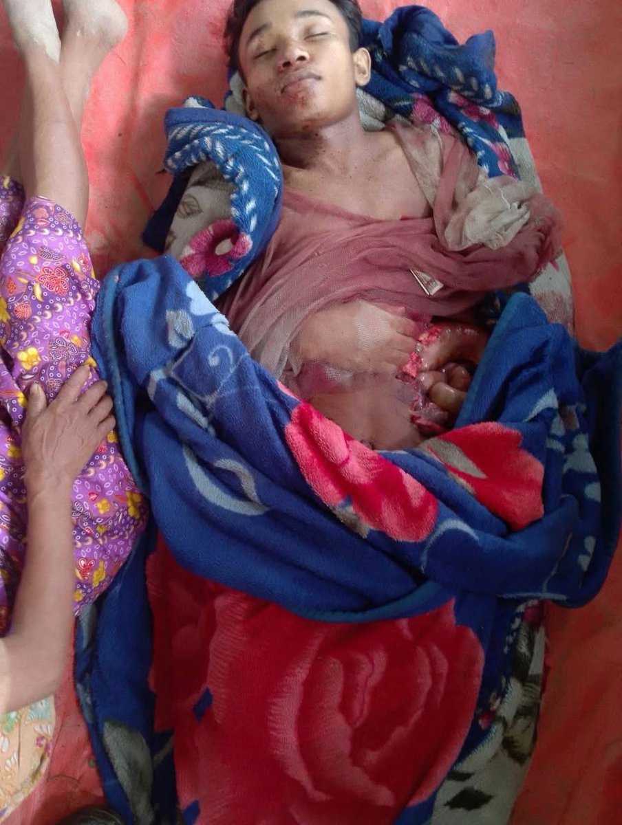 NaingSome9150's tweet photo. The Myanmar military carried out airstrikes on the Tharatapun village in Kyauktaw Township, Arakan State territory under the control of theArakan Army (AA),on the night of September 12,resulting in the deaths of 17 students  and injuriesto20others, according to Local sources. https://t.co/hgeC2zF4CP