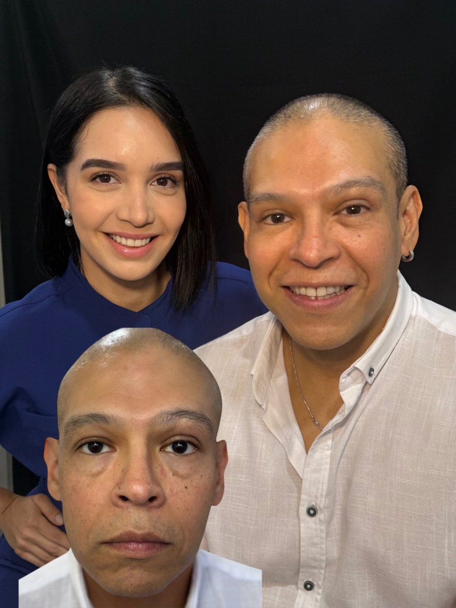 No es magia. 

Es el impacto de una blefaroplastia superior e inferior + procedimientos estéticos sutiles para un resultado natural y elegante.