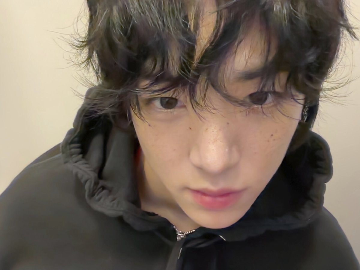 alphasngwn's tweet photo. Freckles https://t.co/RAMDVF9N9d