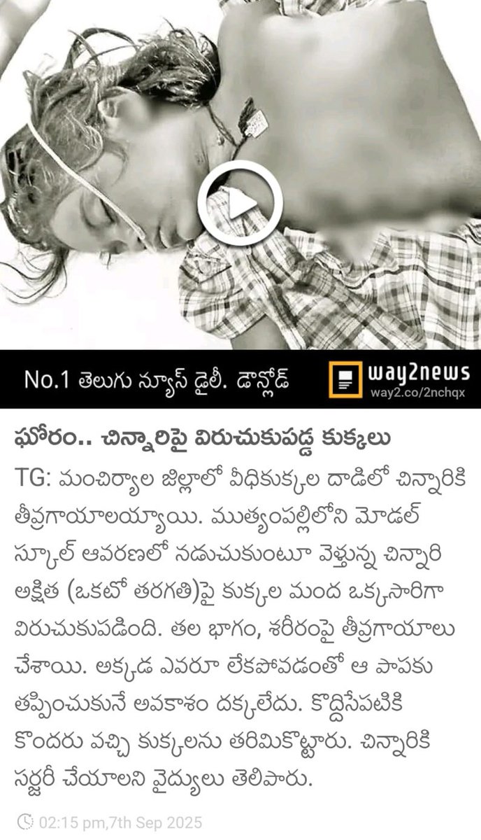 G_Arunkumar2's tweet image. అయ్యా.. @KomatireddyKVR గారు వీధికుక్కల దాడిలో ఇలా ఎంతోమంది చిన్నరులు చనిపోయిన మీకు అవసరం లేదు కదా. కుక్కలను బాగానే ప్రేమిస్తున్నావు కాని ఇక్కడా కుక్కల దాడిలో చచ్చేది నీ పిల్లలు కాదు కదా...! నీ పిల్లలు ఐతే అప్పుడు తెలిసేది ఆ బాధ. మరి  వీళ్ళ సంగతీ ఏంటి...? సమాధానం చెప్పు...?