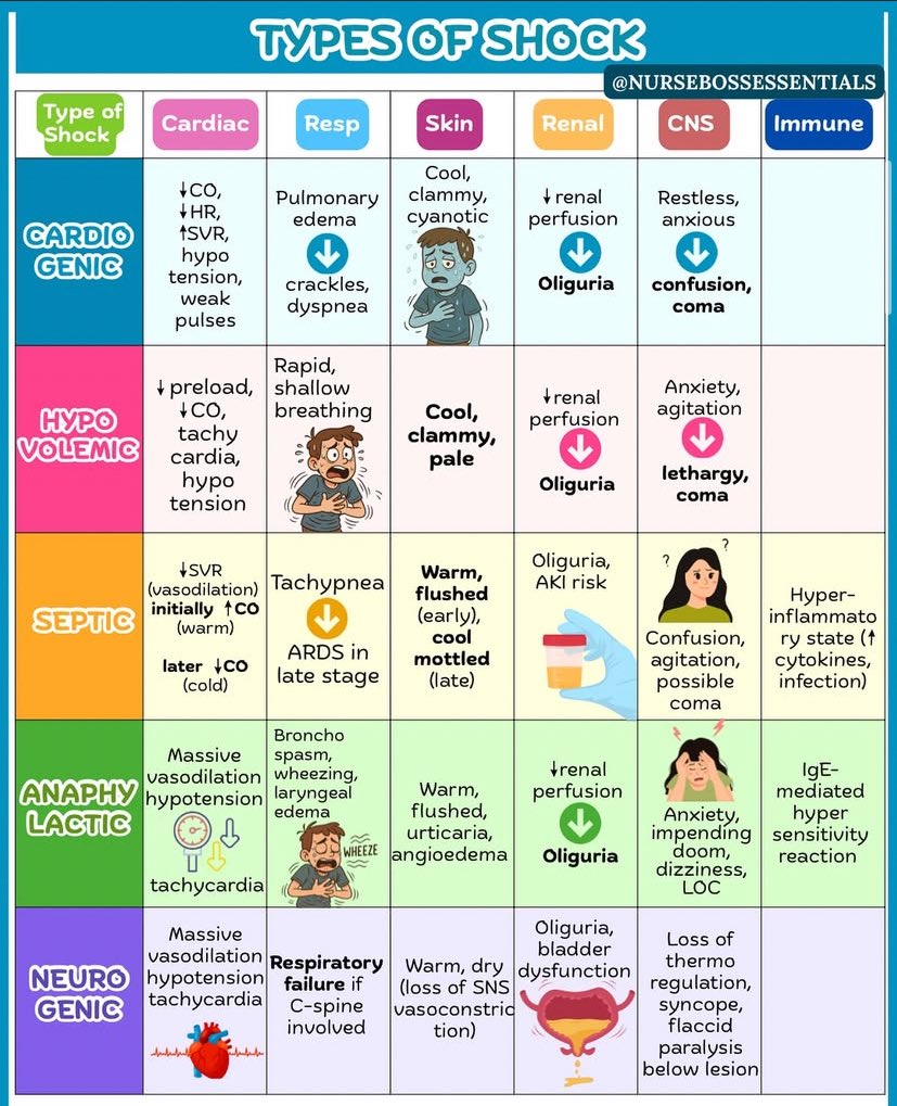 TYPES OF SHOCK

#NursingNotes
#PNLE
#NCLEX