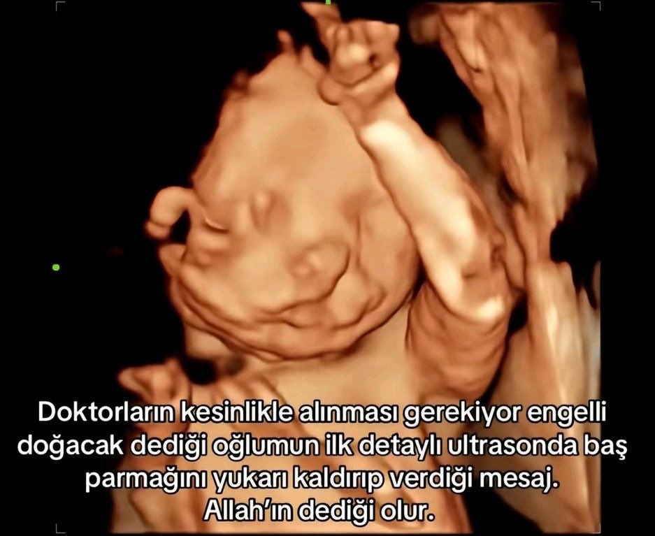 Doktorlar nelerle mücadele etmek zorunda kalıyor ya?

Karşılarındaki hastaların toplumu tehdit edecek ölçüde cehaletine rağmen hala nasıl mesleklerini motive şekilde yapabiliyorlar? Onların bu saçma talepleriyle nasıl sakin kalabiliyorlar?

Doktorlara saygı duyun
Onlar insanüstü.