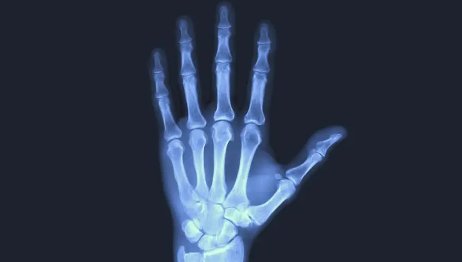 🚨Chinese scientists develop bone glue to fix fractures within three minutes 🤯

[Source : Global Times]