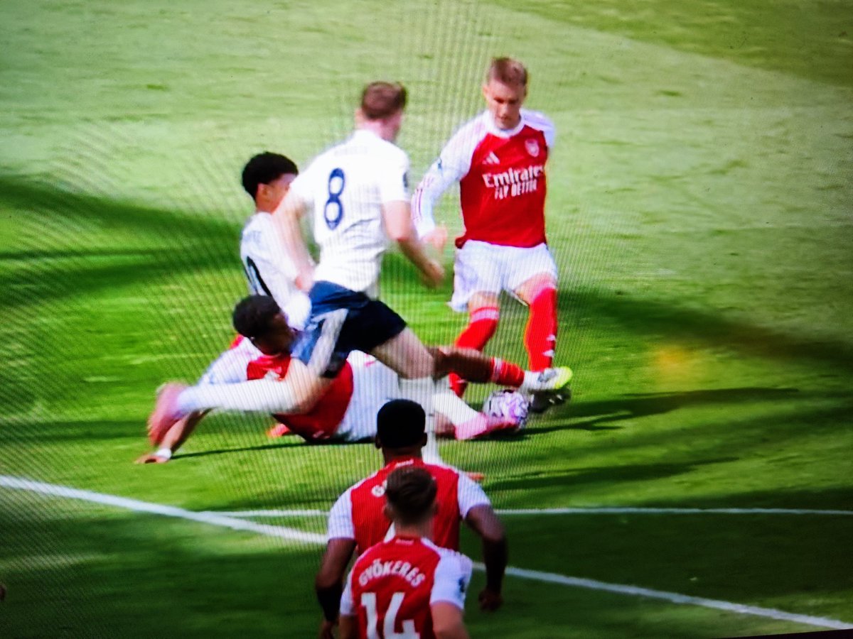 Odegaard musel střídat kvůli zranění v 18.minutě..
Po zákroku. Od vlastního hráče 🥲