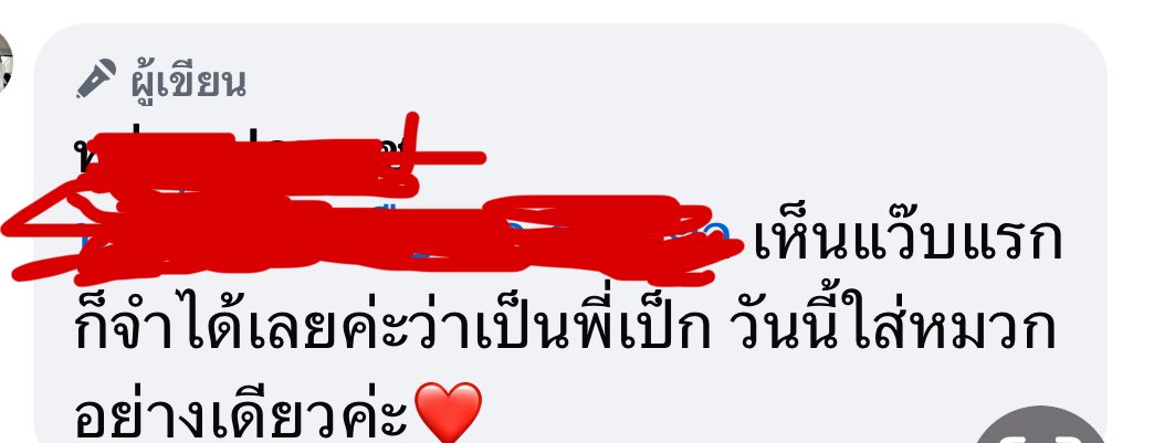 แงงงง แสดงว่าแผลหายดีแล้วแน่ๆเลย🥺 เทคแคร์นะค้าบ💖