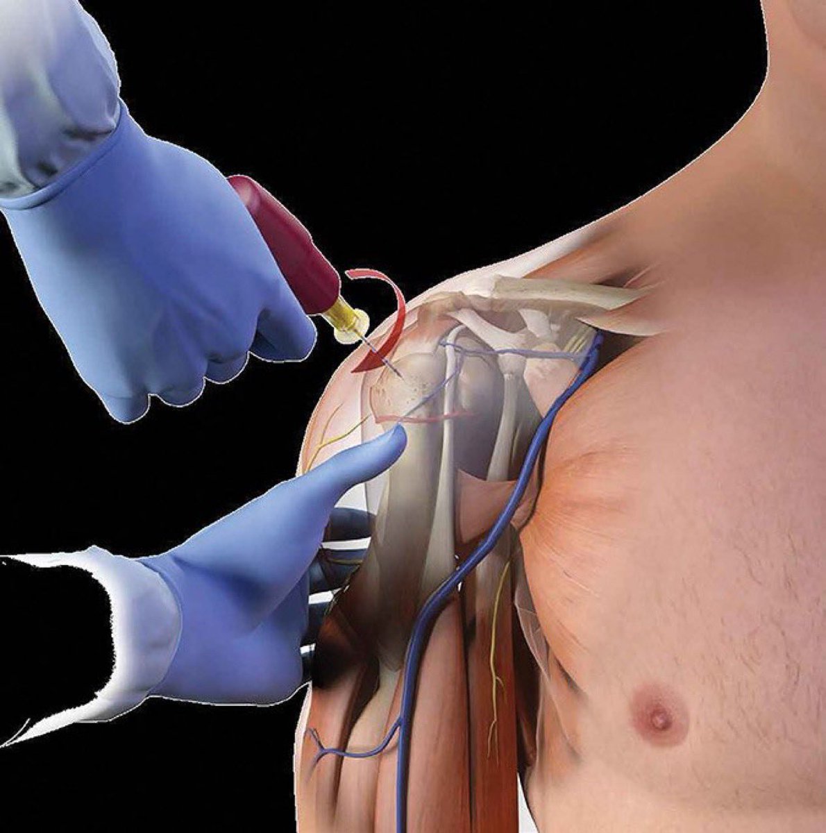 ريان | MD1TALK🌟 tweet media