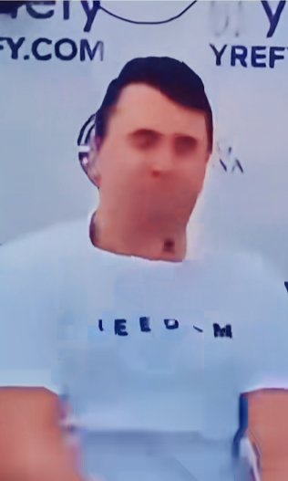 007DrT's tweet photo. This is Not 🚫 a HIGH POWERED RIFLE BULLET HOLE 🕳️ His neck is larger than in other photographs LOOKS 🎦like a Hollywood squid under latex skin 🤡 https://t.co/JRcEkDLIDu