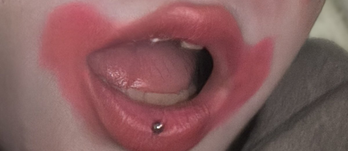 Realizei um sonho de fechar esses dente vei podi