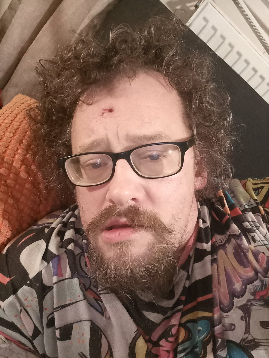 OSSORNUM's tweet image. #SODIUMTHIOSULPHATE CLEANS, CLEARS ALL WATER, 500 BILLION OF THE 10000 BILLION #CHEMICALREACTIONS ARE WORKING #Activated WHICH CAN BE USED TO #CLEANSETOXIC @Thetoxicraine @toxic #Toxic 80-90-100% of #TOXICENDPRODUCT CAN BE CURED BY #FERMENTATION #HYDROLYSIS #DISTILLATION #NEWSTO