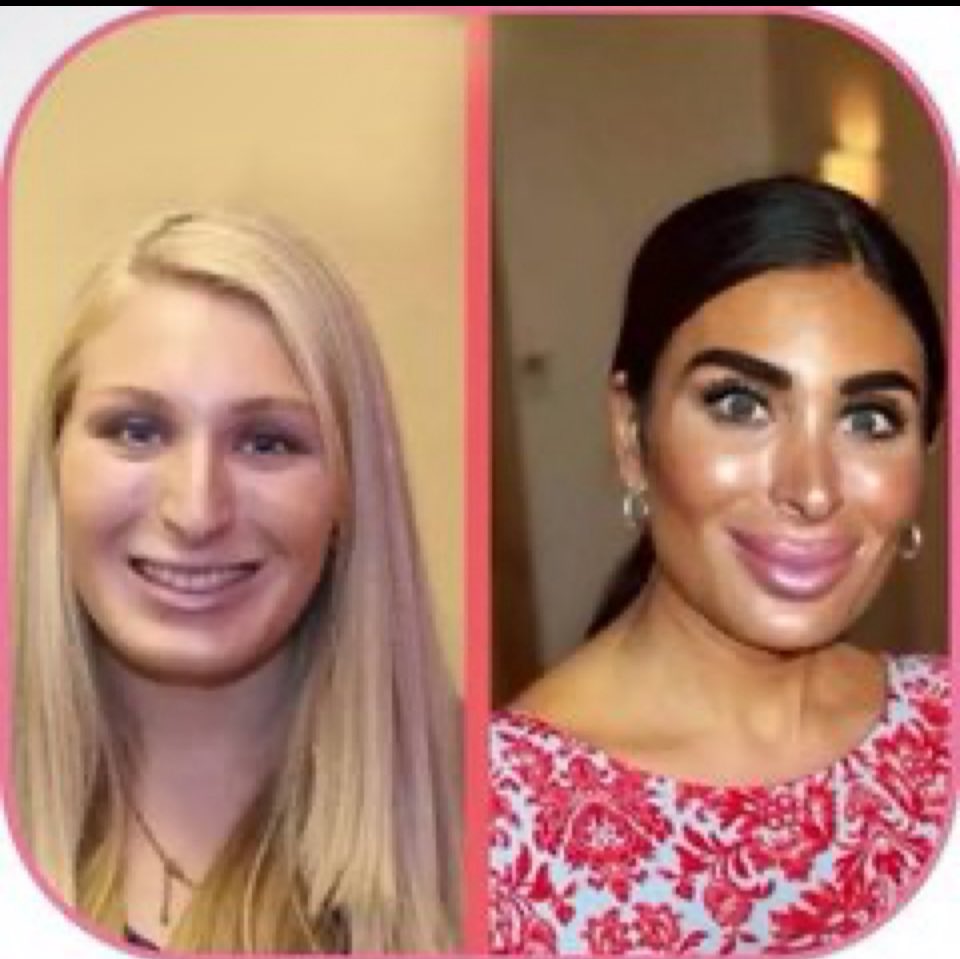 ScribeLumpy's tweet image. This is actual TDS:
@LauraLoomer