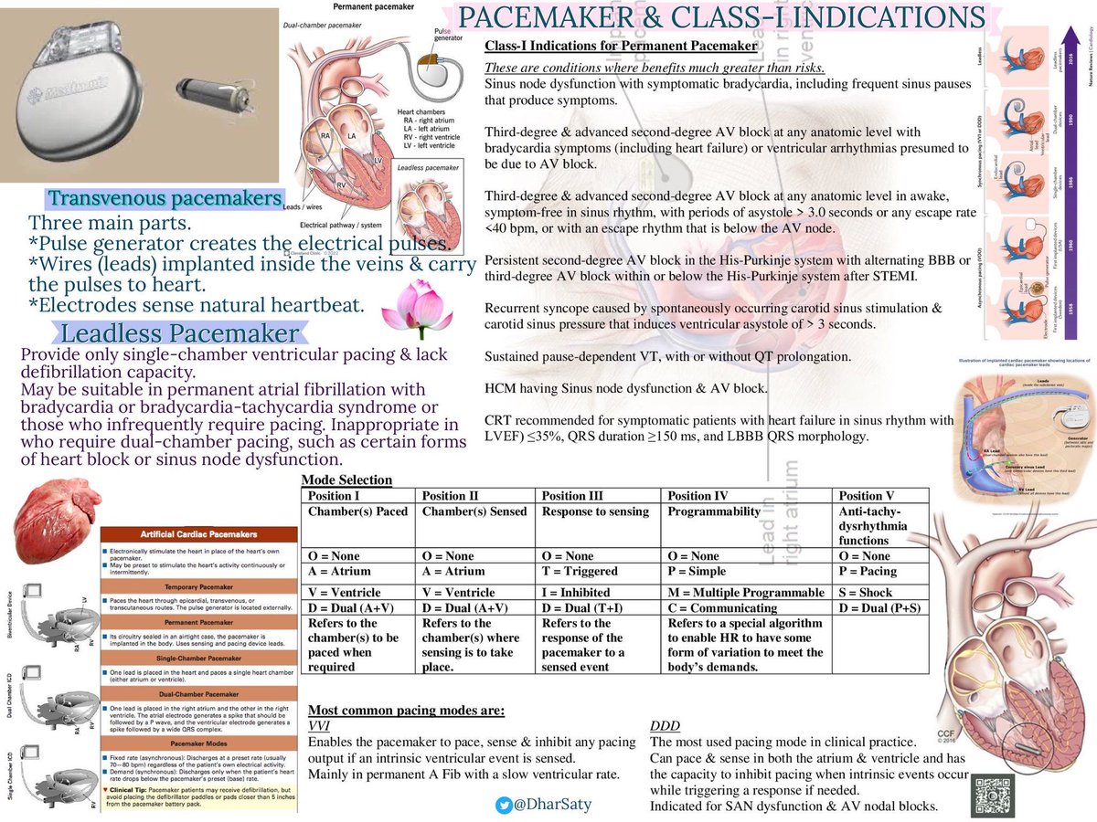⚡️ 𝗠𝗮𝗿𝗰𝗮𝗽𝗮𝘀𝗼𝘀 – 𝗜𝗻𝗱𝗶𝗰𝗮𝗰𝗶𝗼𝗻𝗲𝘀 𝗖𝗹𝗮𝘀𝗲 𝗜
⬇️⬇️⬇️⬇️

🔹 Indicados cuando el beneficio supera claramente el riesgo.

➡️BAV 3º grado o BAV avanzado sintomático
➡️Pausas sinusales &gt;3 seg
➡️Disfunción del nodo sinusal sintomática
➡️QT prolongado con TV sostenida