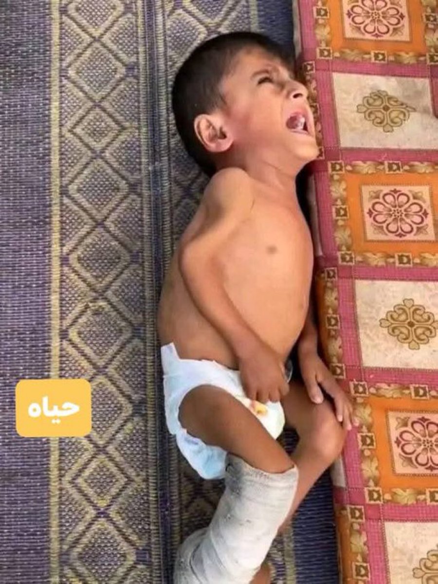 Are you still with us !! Do you hear us !!! 💔

If you’re scrolling, PLEASE leave a dot . it's just a dot .
chuffed.org/project/138261…