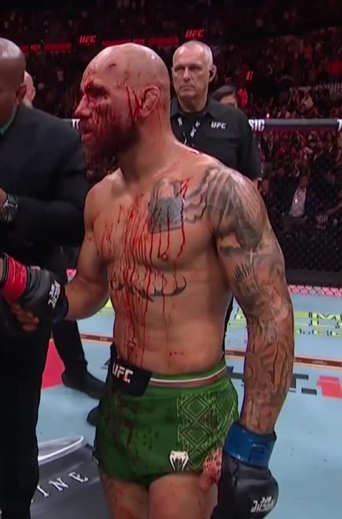 OH MY GOD DIEGO LOPES PHYSICALLY DESTROYED JEAN SILVA #UFCNoche