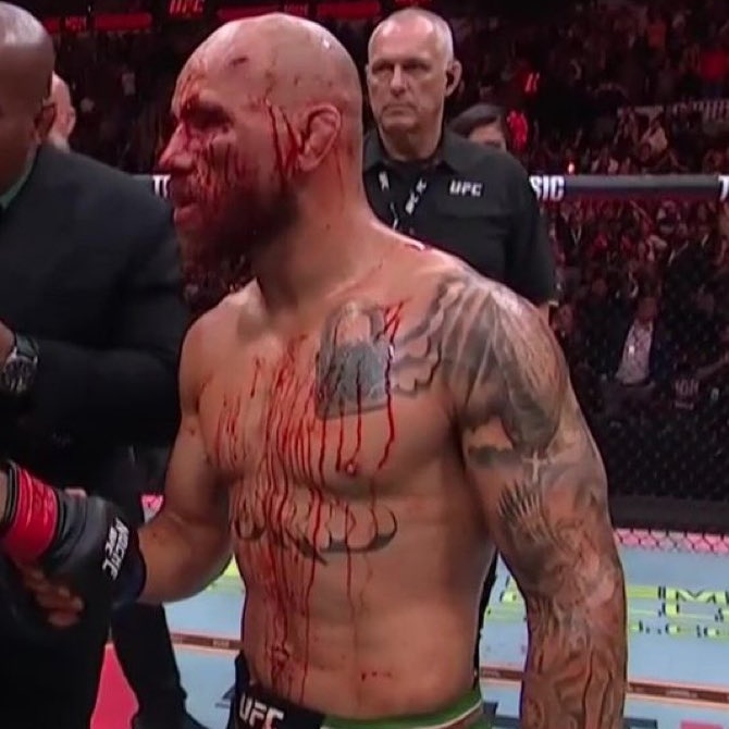 How it started    vs    How it's going #UFCNoche