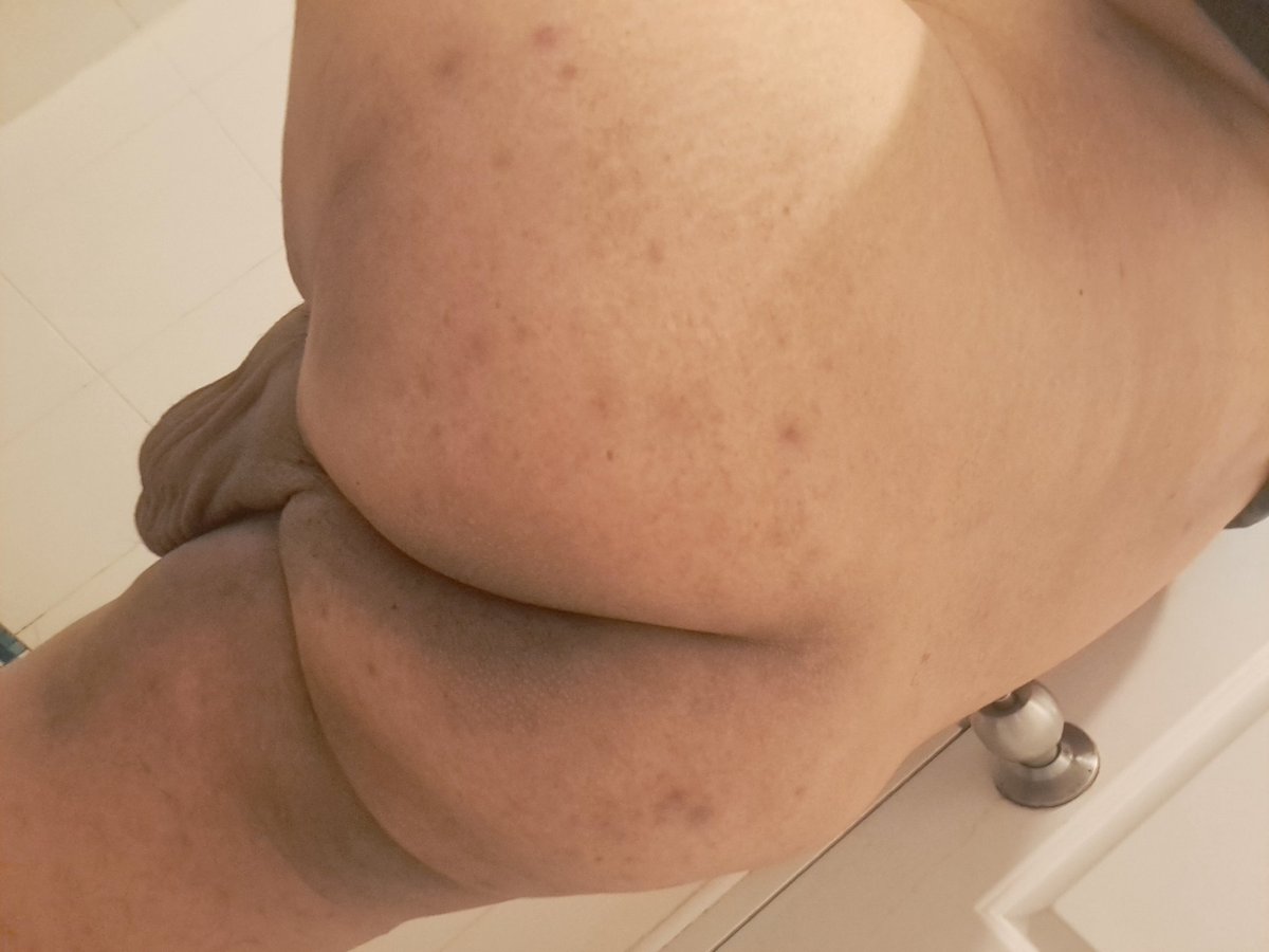 ไข่ยานหมดแล้วว 🫣🫣