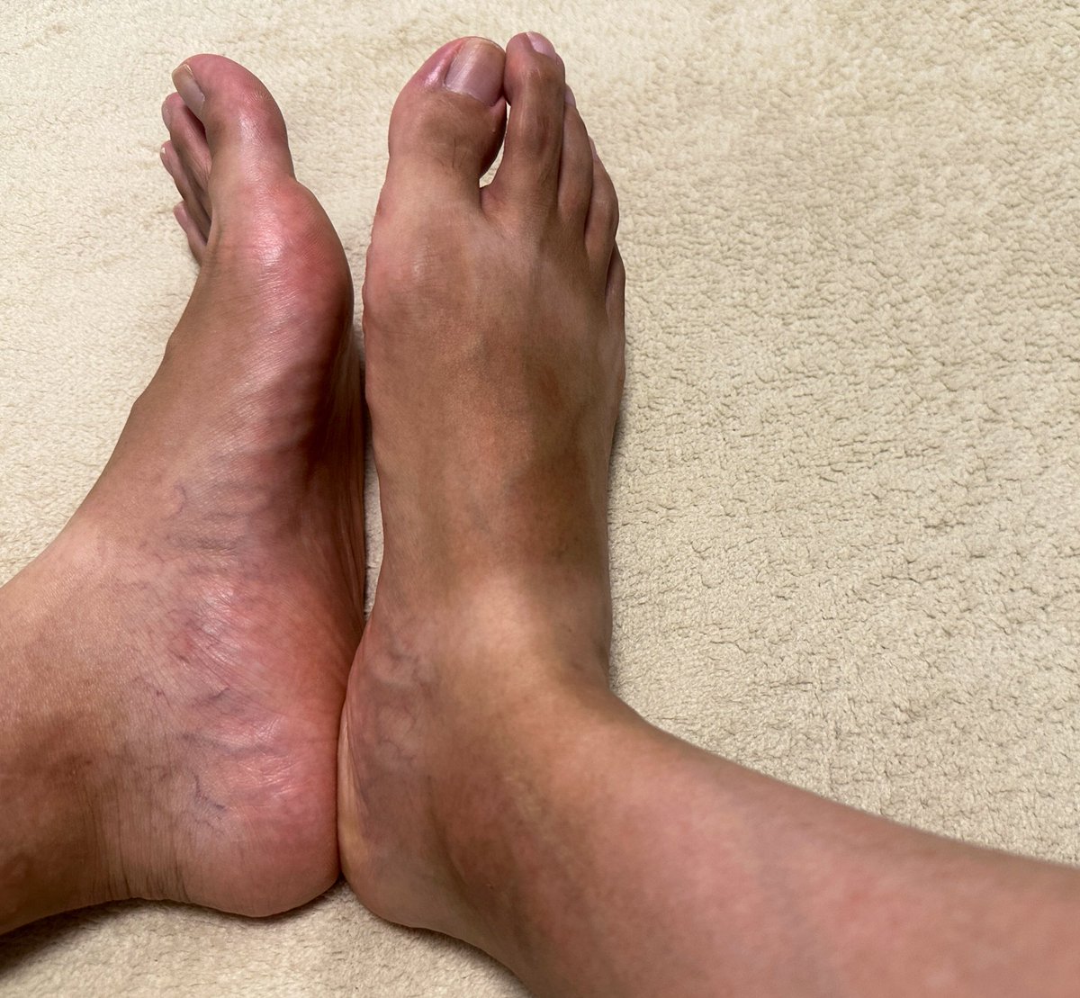 足舐め tweet media