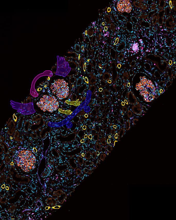 hjanders_hans's tweet photo. Check out the new entries of the Kidney Art gallery 
@ERAkidney @NDTsocial 

Don`t hesitate  to submit your creative kidney art, too? You may end on the cover page of NDT...

https://t.co/dQAeowCLfd https://t.co/7fxDm7Q7Wc