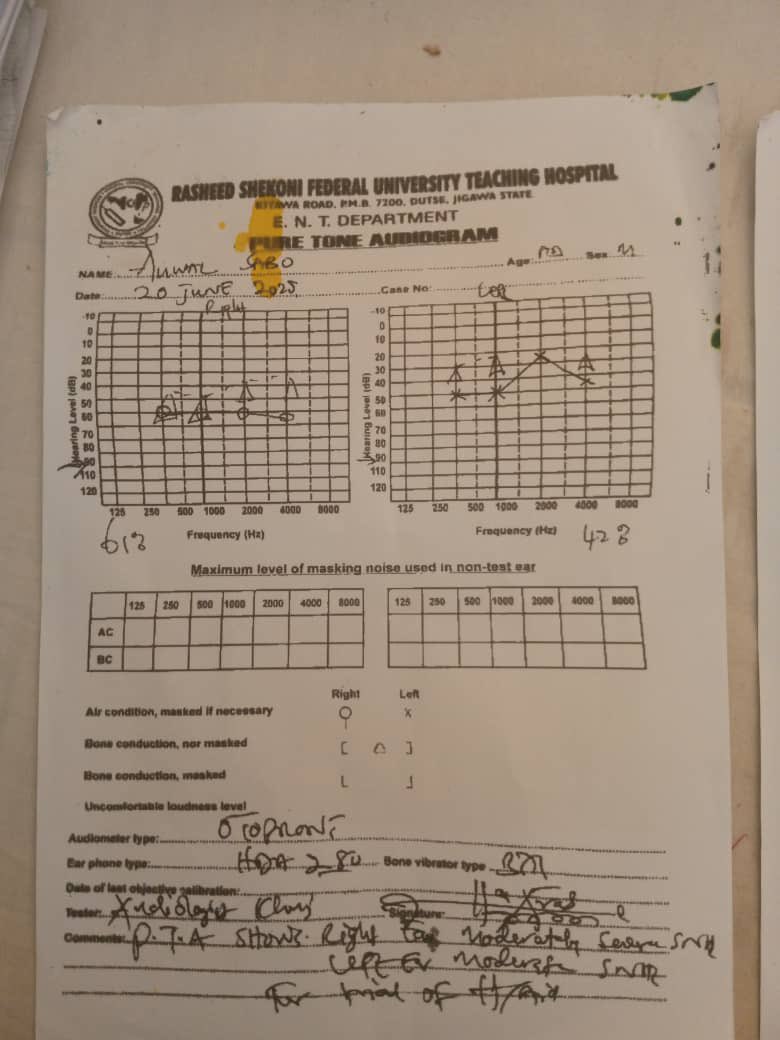 Please We are seeking support for Auwalu Sabo, a patient with serious ear problems, as diagnosed at Rasheed Shekoni Hospital Dutse and FMC Birnin Kudu. He urgently needs ₦200,000–₦400,000 for treatment. Kindly assist with any amount you can.
Acct No: 8039572523 | Bank: Palmpay