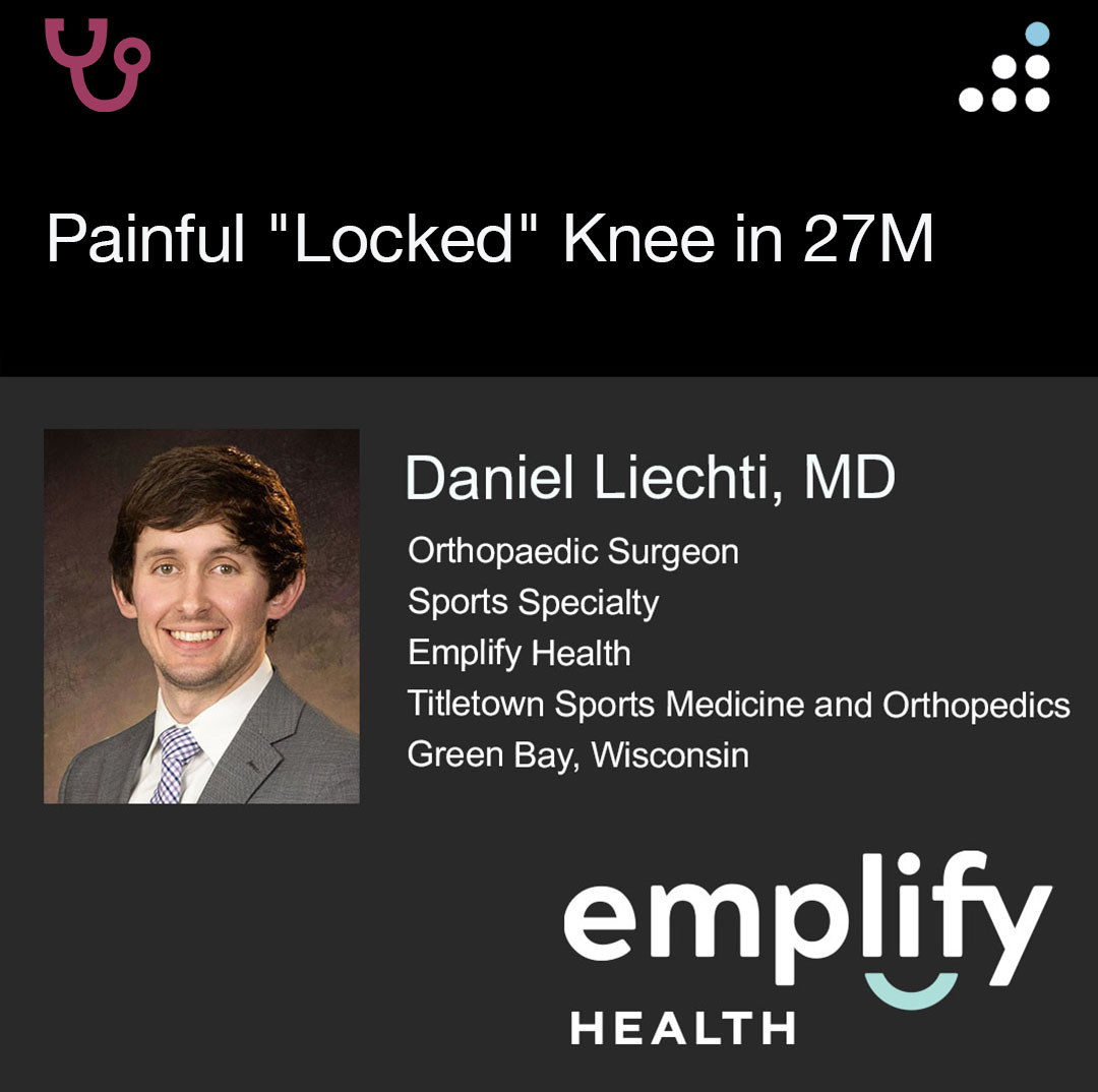 Here are the intraoperative arthroscopic images of yesterday's case by Dr. Daniel Liechti <a href="/DanielLiechtiMD/">Daniel Liechti, MD</a> and Emplify Health Titletown Sports Medicine and Orthopedics <a href="/emplifyttown/">Emplify Health by Bellin Titletown</a>.

BUCKET HANDLE MENISCUS TEAR IN 27M

PROCEDURE: ALL-INSIDE + INSIDE-OUT REPAIR (HYBRID) MENISCAL