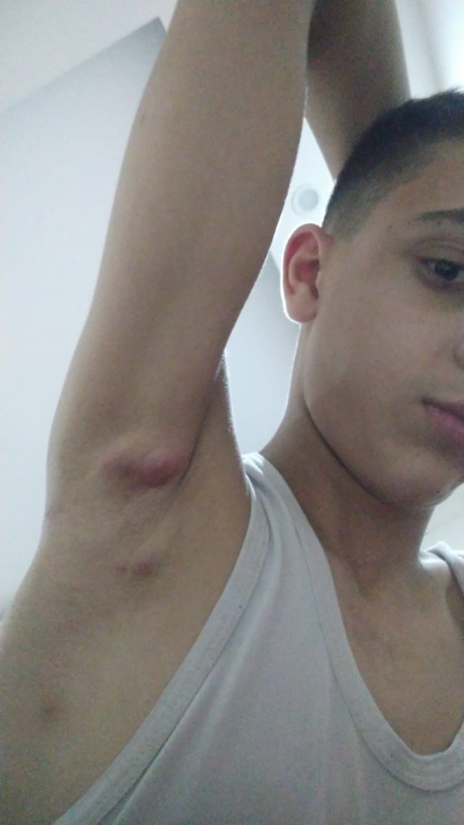 My sons Omar (15) and Kareem (13) 💔 are innocent children.
We are not terrorists, we are just a family struggling to survive.
I beg you in the name of humanity 🙏
Please stand with us and help save their lives.
➡️ chuffed.org/project/134095