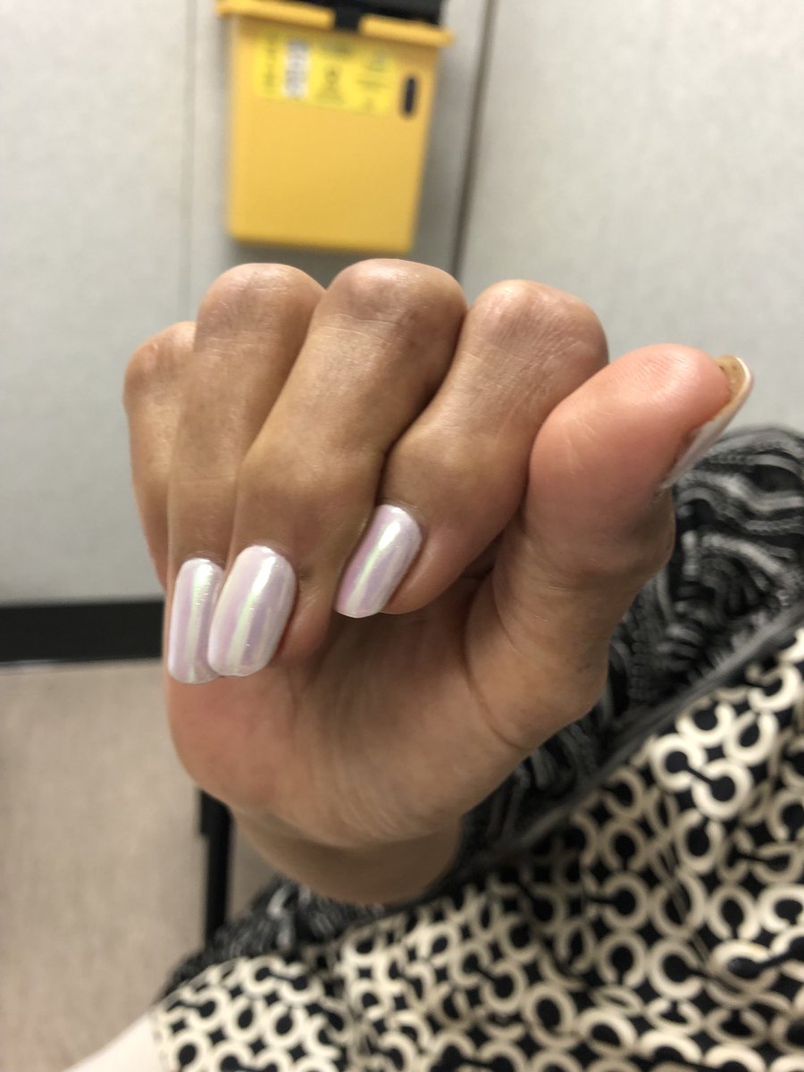 Janetbirdope's tweet image. #ClinicalPearl 

#common
#bony changes at some #knuckles 
#worse on #dominant #hand 
Can’t make a proper fist 👊 

#Diagnosis in 1 #picture
