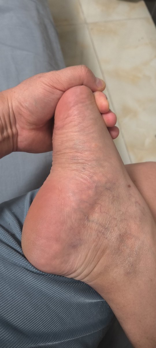 Man with small feet tweet media