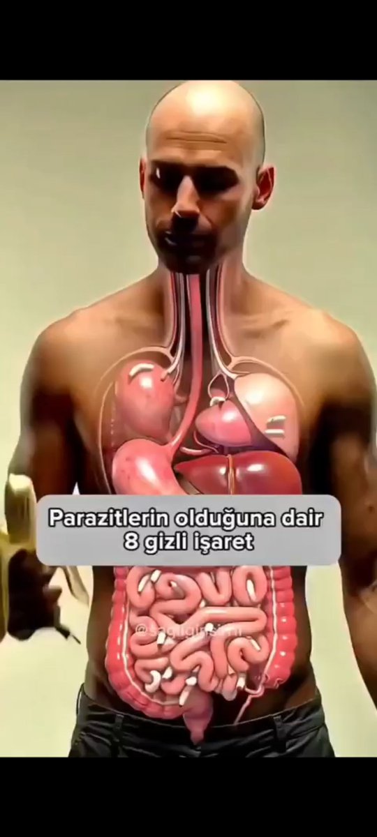 Hem situs invertus var, kalp nerde??? Akciğerlere hava balonudur diyip çizmemiş? Boyundan inen beyaz şey Vagus mu? Yapay zeka anatomi hocalarının yerini alamayacak gibi