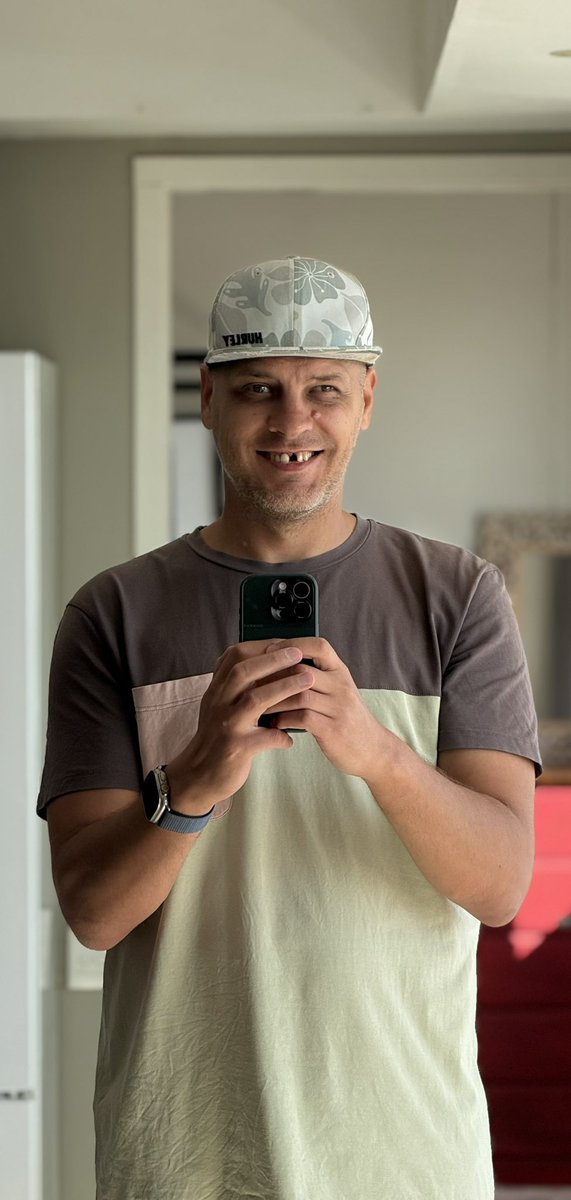 plastt's tweet image. Это ж надо, как одна маленькая деталь, моментально делает тебя похожим на бездомного алкаша 😁

Зуб пал в неравном бою с кистой.
Впереди веселые несколько месяцев операций и тяжелые удары по моему кошельку 😩