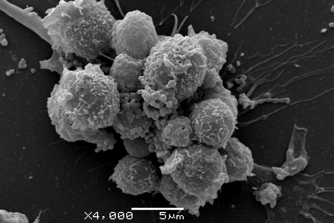 These are natural killer cells, naturally detecting abnormal cells. TRI-based <a href="/Fer_NK_nando/">Fernando Guimaraes</a> from <a href="/UQ_News/">UQ News</a> leads development of an immunotherapy treatment for children, using NK cells to destroy tumours. “They offer unique advantages.” bit.ly/3VHKGdJ