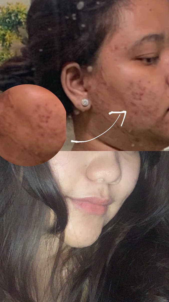 Indoganic Beauty tweet media