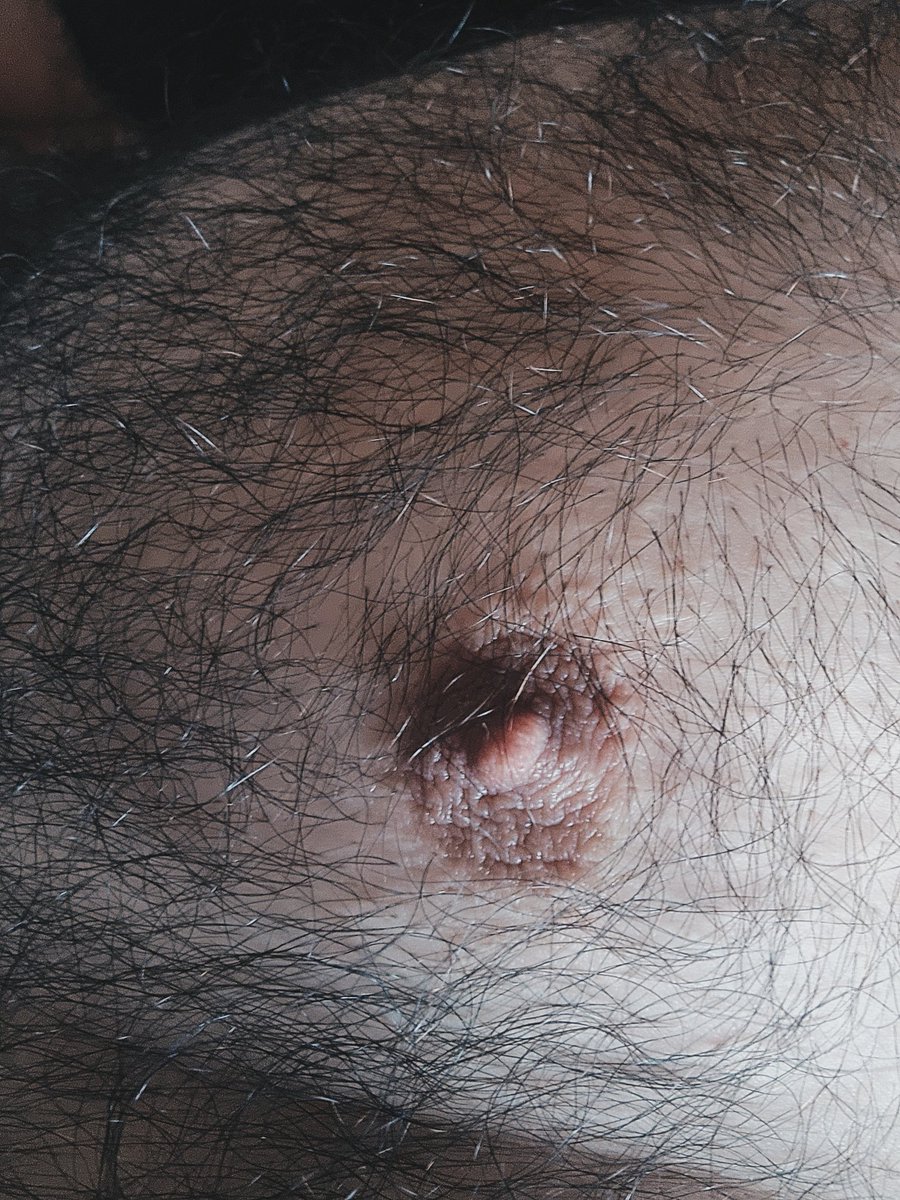 Vitiligo_Bear85 tweet media