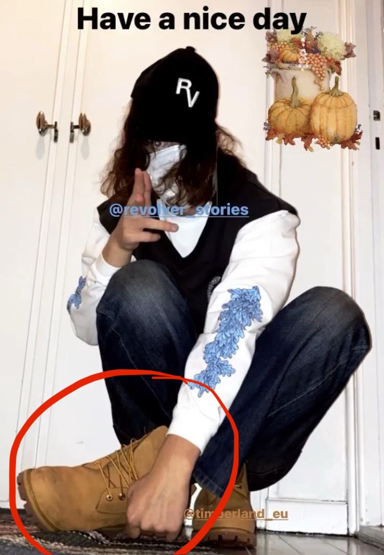 What’s happening w this mfs foot???