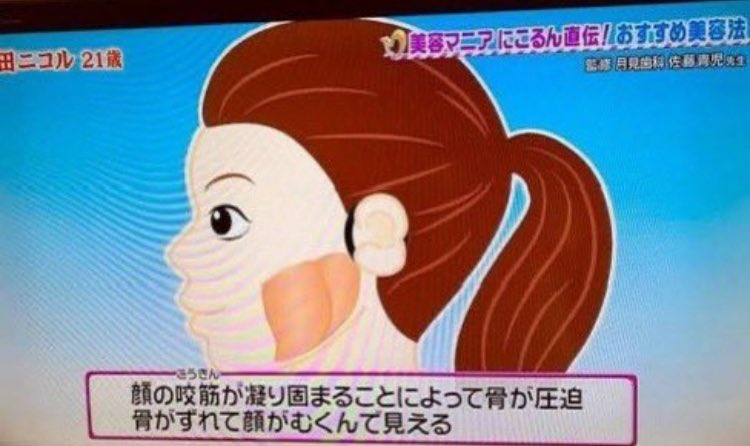 k_n_m_0307's tweet photo. 藤田ニコル激推し㊙️㊙️
輪ゴム2本でできる小顔矯正が効果抜群すぎてやばい
5000円する小顔矯正よりまじで効果あった。
効果ありすぎて、モデル仲間に絶対教えないらしいww https://t.co/4phbWyHqsd