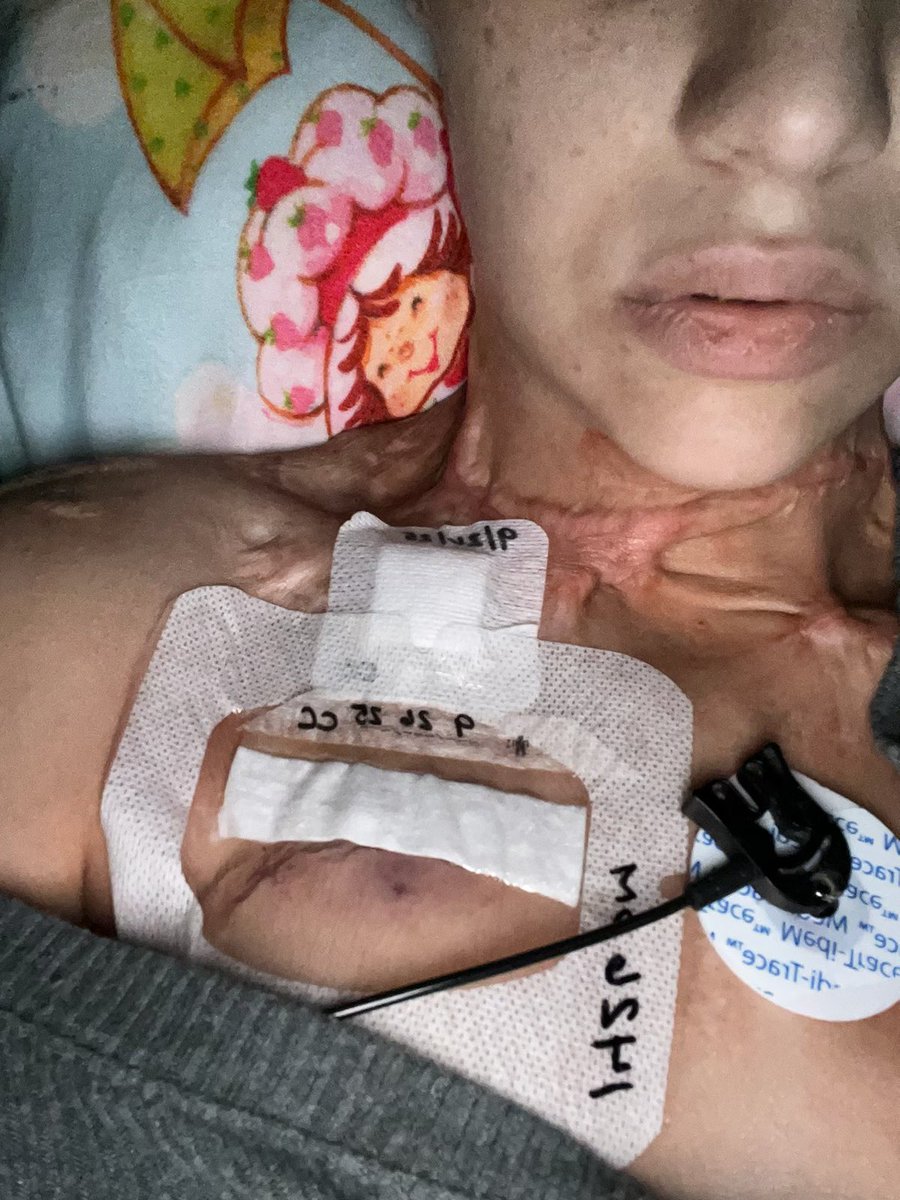 DiedSuddenly_'s tweet image. 🏥 ALEXIS UPDATE 🚨

Alexis was vaccine injured and moved to Florida this past month.

She caught ecoli recently, and got incredibly sick and almost died, and was hospitalized.

She is finally able to shower by herself because a port has been placed on her chest.

AdventHealth…