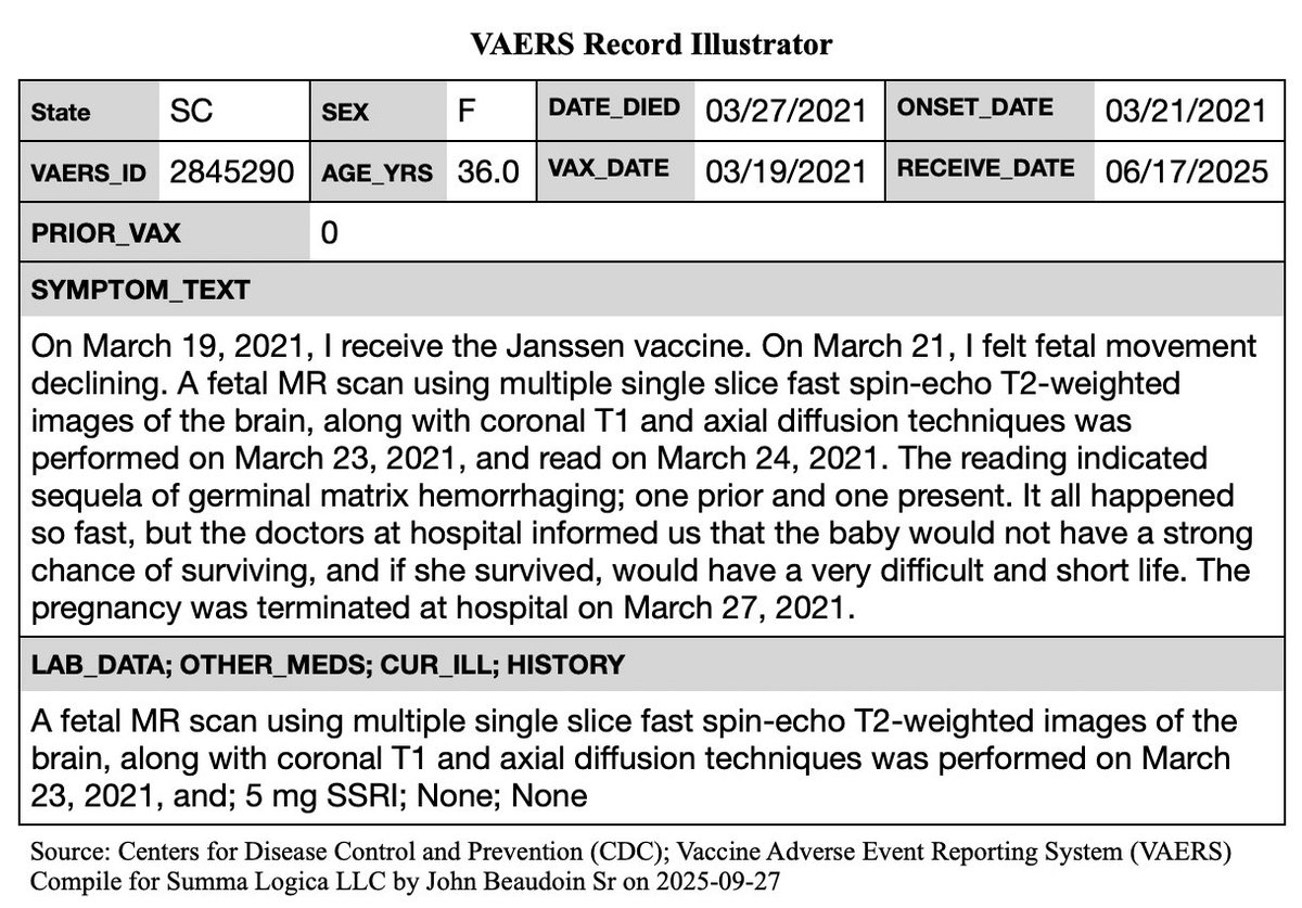 John Beaudoin, Sr. aka, The Real CdC (@johnbeaudoinsr) on Twitter photo US medicine is run by demons
<a href="/SecKennedy/">Secretary Kennedy</a> HELP US
READ THESE TO <a href="/realDonaldTrump/">Donald J. Trump</a>
I can provide death records for others. How many do you need? Say a number. I'll get them
You do NOT need 6 months studies. I have conclusive evidence CDC has been deleting vx as cause of death US medicine is run by demons
<a href="/SecKennedy/">Secretary Kennedy</a> HELP US
READ THESE TO <a href="/realDonaldTrump/">Donald J. Trump</a>
I can provide death records for others. How many do you need? Say a number. I'll get them
You do NOT need 6 months studies. I have conclusive evidence CDC has been deleting vx as cause of death
