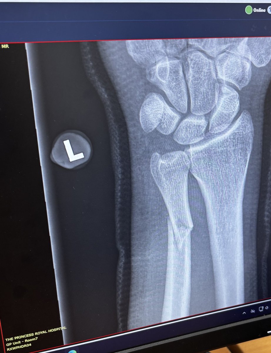 Brandon Hall tweet media