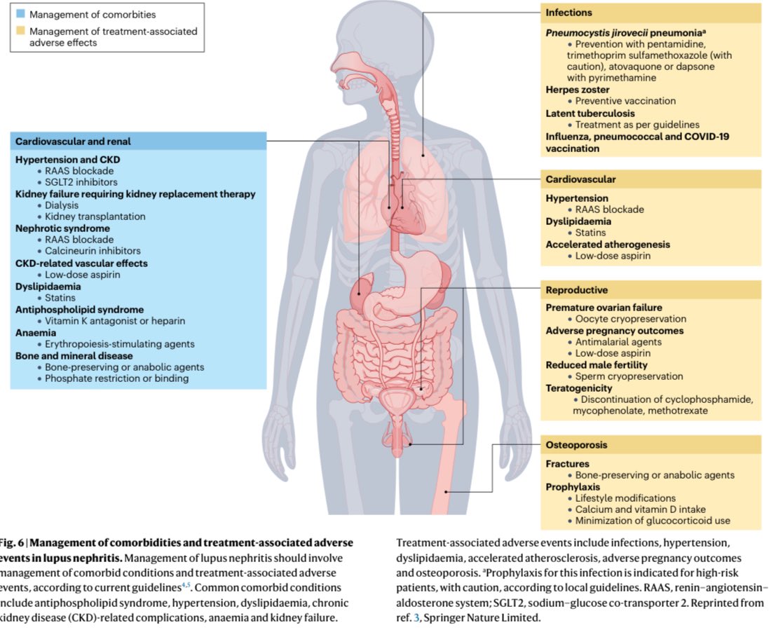 Ioannis Parodis (@ioannisparodis) on Twitter photo New #Nature Reviews Disease Primer on #lupusnephritis.
rdcu.be/eH6A4
Happy to have contributed!
Work done together with respected colleagues <a href="/MohanLab2/">Mohan Lab</a> <a href="/BradRovin/">Brad H Rovin</a> <a href="/hjanders_hans/">Hans-Joachim Anders</a> <a href="/MariaTektonidou/">Maria Tektonidou</a> <a href="/AnaMalvar4/">Ana Malvar</a> and CC Mok
<a href="/parodislab/">Parodis lab</a> #lupus New #Nature Reviews Disease Primer on #lupusnephritis.
rdcu.be/eH6A4
Happy to have contributed!
Work done together with respected colleagues <a href="/MohanLab2/">Mohan Lab</a> <a href="/BradRovin/">Brad H Rovin</a> <a href="/hjanders_hans/">Hans-Joachim Anders</a> <a href="/MariaTektonidou/">Maria Tektonidou</a> <a href="/AnaMalvar4/">Ana Malvar</a> and CC Mok
<a href="/parodislab/">Parodis lab</a> #lupus