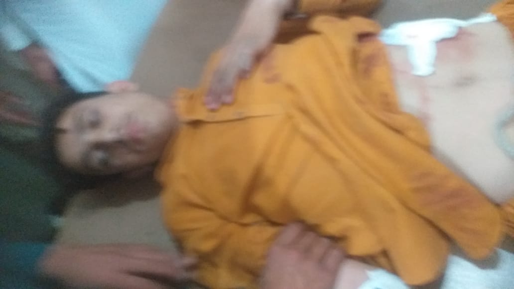 باجوڑ۔گاؤں لغڑئی تحصیل لوئی ماموند میں بچوں پر ڈرون حملہ، حملے میں چار بچے شہید جبکہ دو شدید زخمی کئے گئے ہیں۔
لغڑئی کو سیکیورٹی فورسز نے کلئیر قرار دیا ہے اور بڑا گنجان آباد علاقہ ہے۔
پہلے ہی دن سے نام نہاد ٹارگٹڈ اپریشن می۔۔۔
#باجوڑ #اپریشن #ماموند #سویلیئنز #ظلم