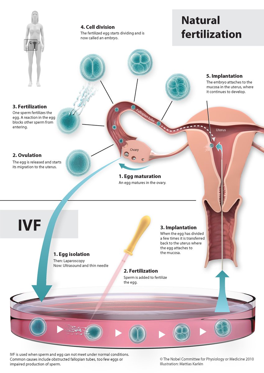 Do you know anyone who has been helped by human in vitro fertilisation  (IVF) therapy? Robert Edwards was awarded the 2010 Nobel Prize for the  development of human in vitro fertilisation (IVF), image size:849x1200