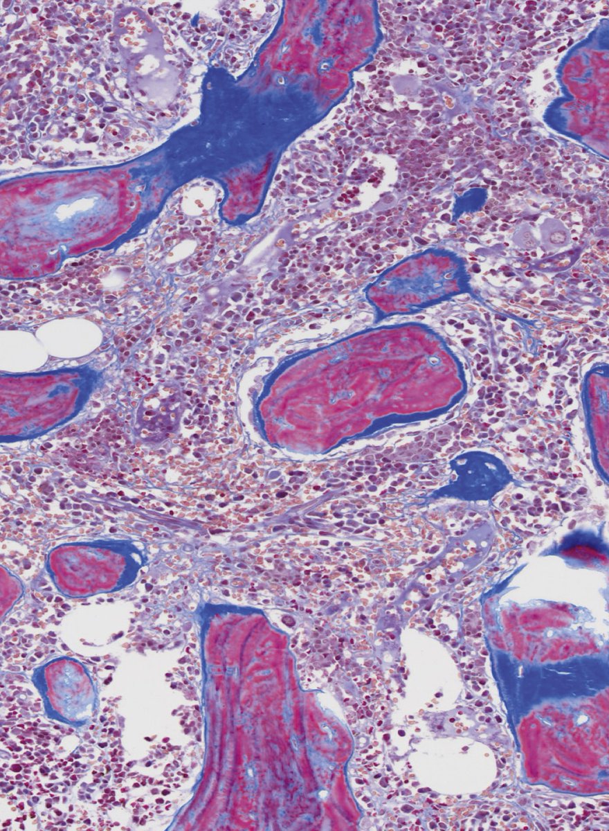 Thank you <a href="/BloodPortfolio/">Blood Journals Portfolio</a> for making our recent paper figure " Cover Page of Volume 146, Issue 13"!
Also, special thanks to Isabelle C. Becker for writing commentary on our recent article at Blood.
Cover page link: ashpublications.org/blood/issue/14…
Commentary: ashpublications.org/blood/article/…