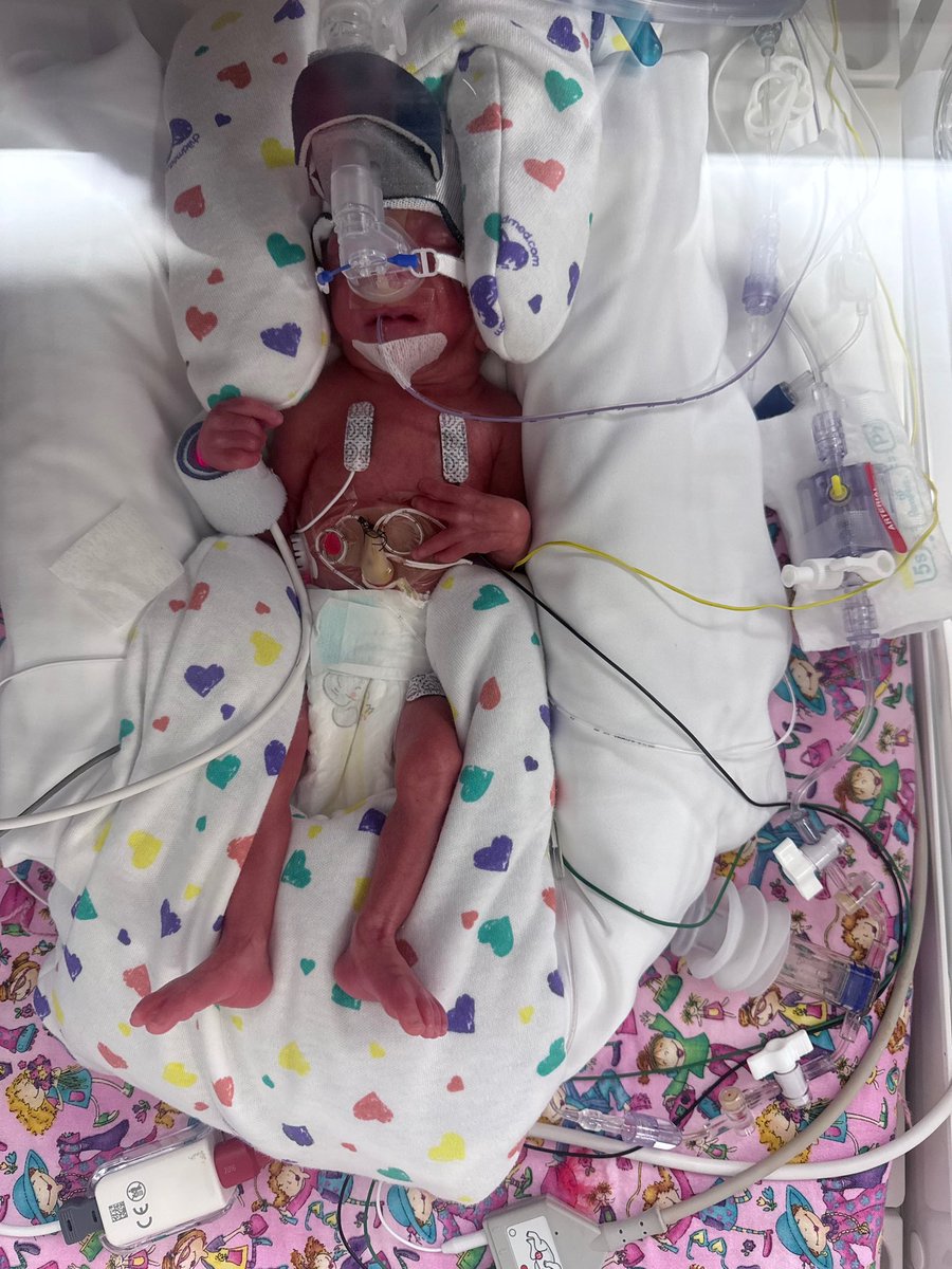 Gators Breakdown Plus member, Rob, could use some support.

“Our little SadieLynn had to be delivered by emergency C-section unexpectedly at 26 weeks and 5 days, only weighing 1 pound and 14 ounces.”

“Our little warrior will be spending the first few months of her life in NICU.